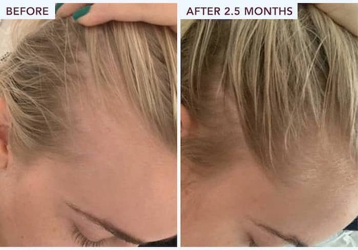 Rosemary Hair Growth Spray
