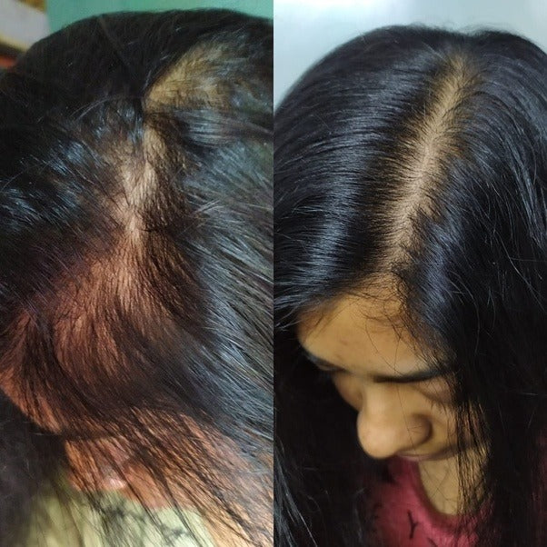 Rosemary Hair Growth Spray