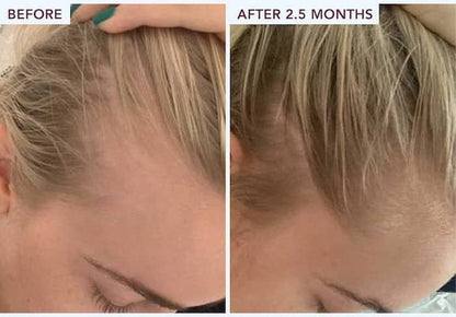 Rosemary Hair Growth Spray